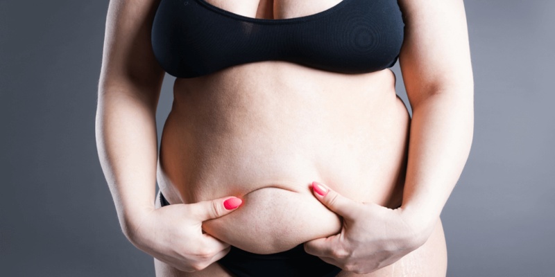 I am Considering A Mommy Makeover. Should I Lose Weight First?