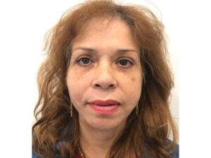 after asian facelift front view female patient case 8930